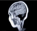 brain_medical_mri_platinum