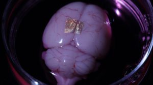 Gold nanowire array on a rat brain.